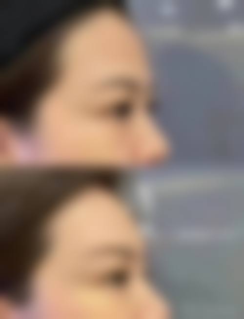 总结