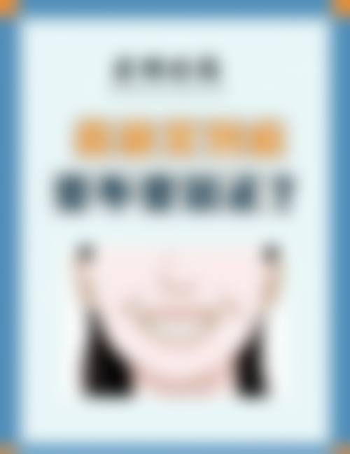 预约优惠活动