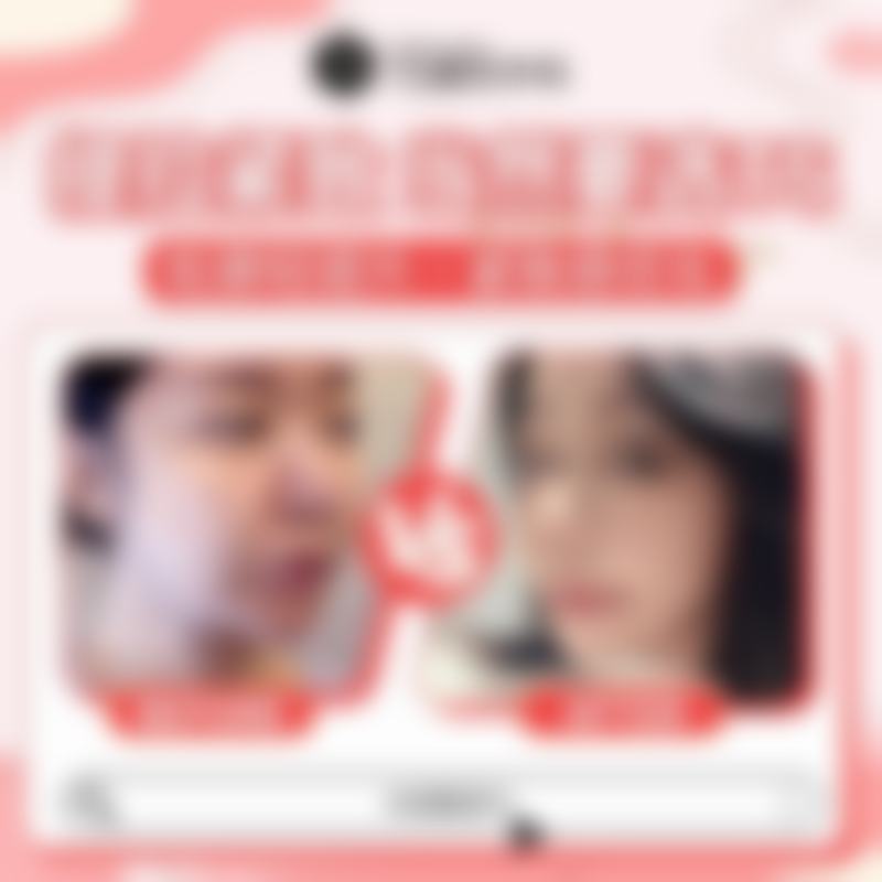 我的胸部整形真实经历：从平胸到饱满挺翘曲线的蜕变