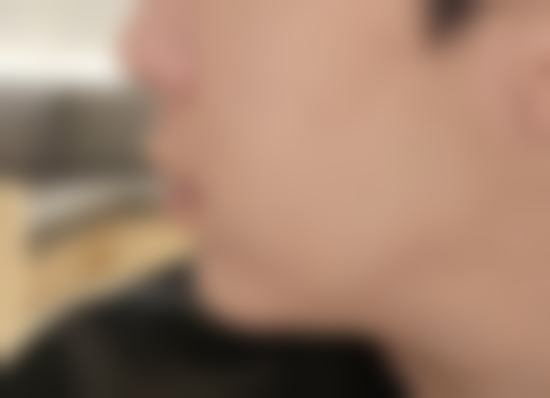 幸运的转折:缘遇韩国TS整形医院与李相均院长