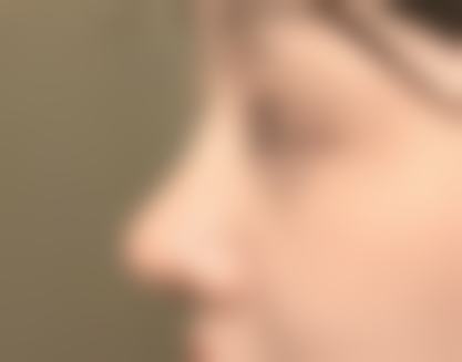 常见问题(FAQ):关于韩国TS整形医院权侑霞医生优势的热门问答
