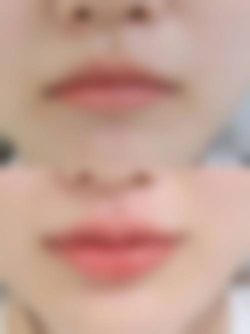 常州东美整形医院怎么预约挂号?