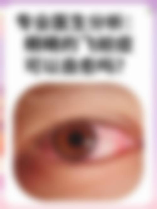 FAQ(常见问题)