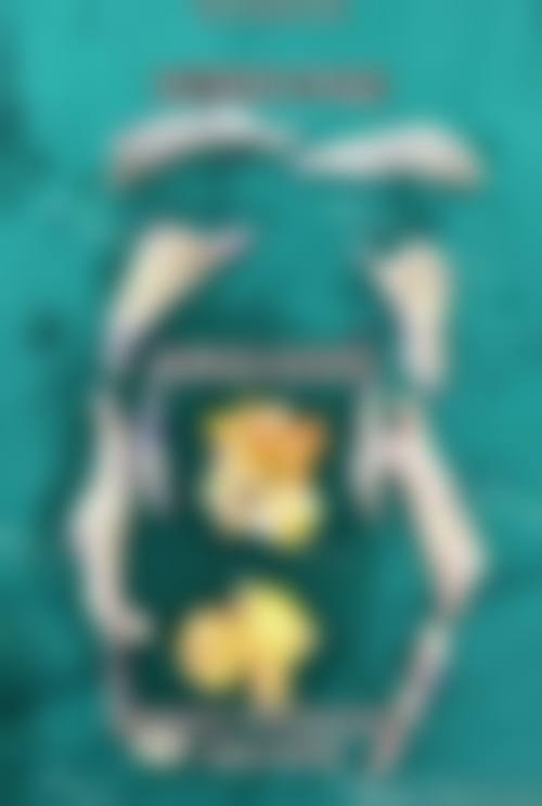 预约优惠活动