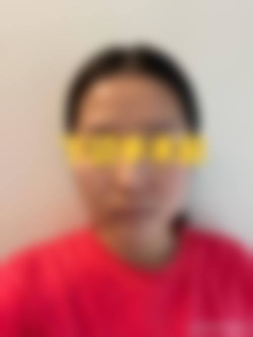 特色项目与专精优势：无痕隆鼻、双眼皮、颌面整形等经典技术