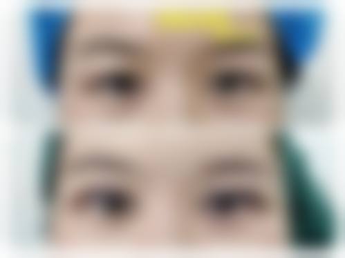 雅安市人民医院烧伤整形科项目价格参考