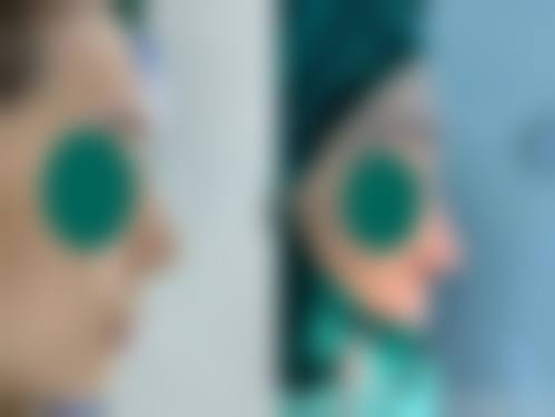 擅长项目详解