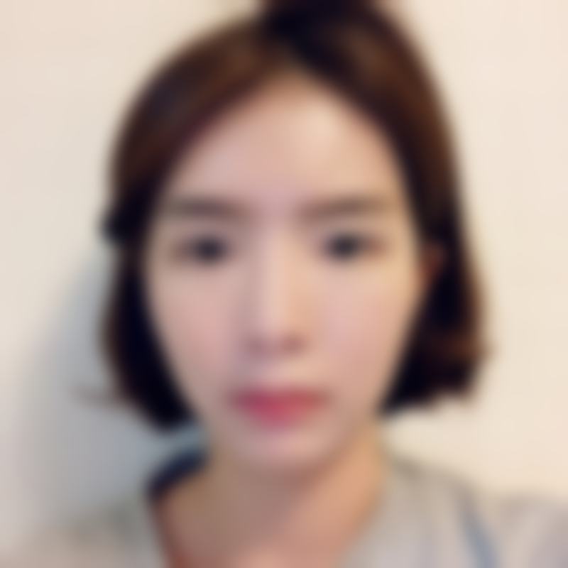 医院优势:韩国TS整形医院徐梃华收费价目表 透明与实力并存