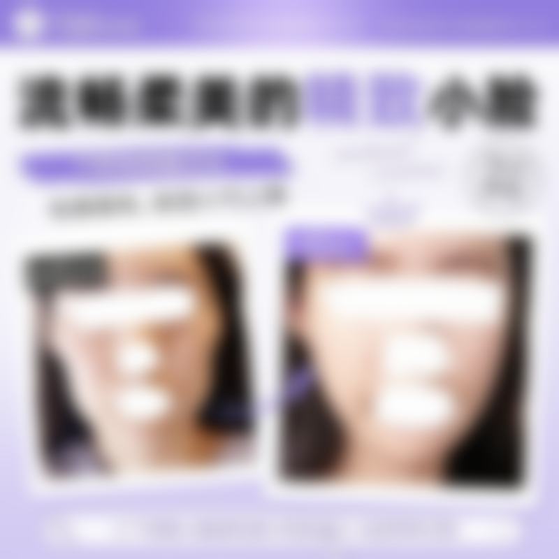 常见问题(FAQ):关于韩国TS整形医院徐梃华收费价目表 用户更关心的5个问题