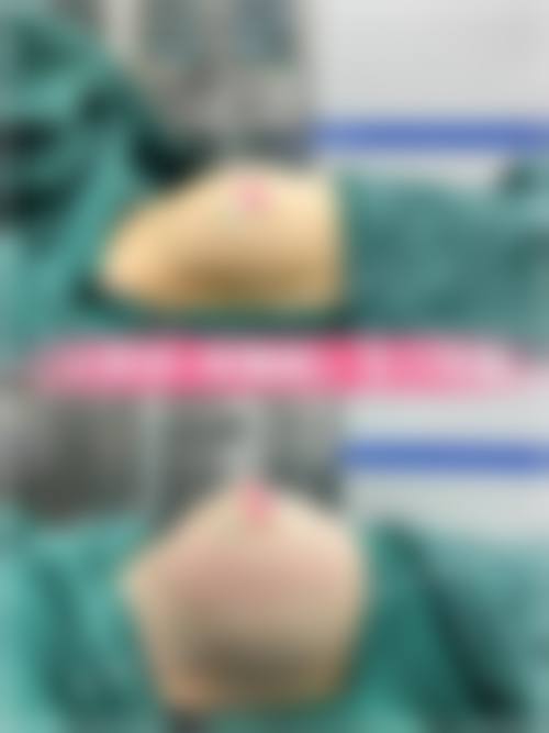 临床实例分享