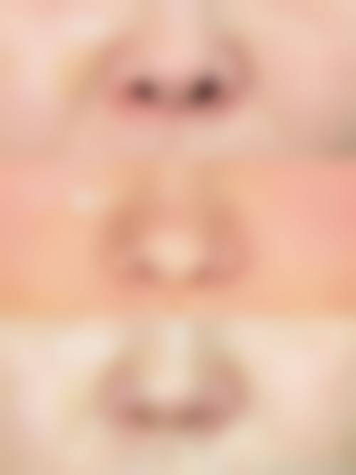 患者真实评价