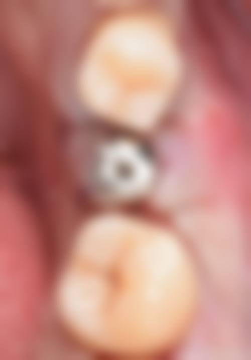 常见问题解答