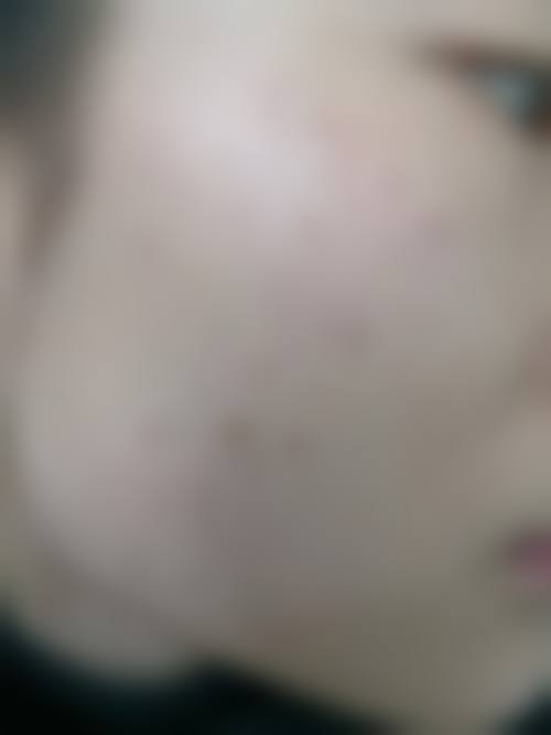 北京瑞丽舍整形美容医院擅长项目