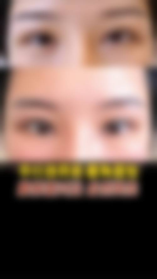 哈医 大四院美容科临床典型服务范例