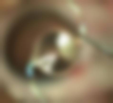 优惠活动详情：原价对比，限时补贴