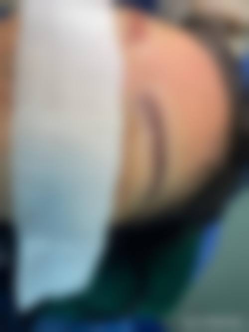 上海圣爱医院整形科怎么预约挂号?