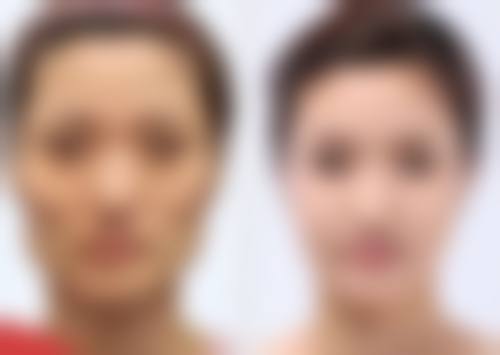毛艳红擅长项目列表