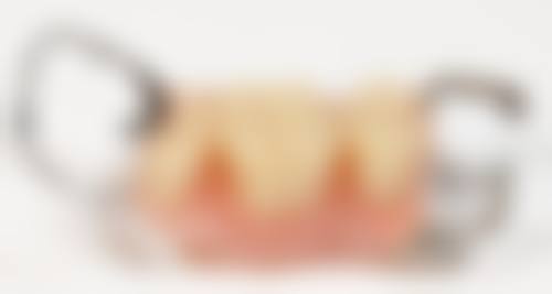 常见问题解答