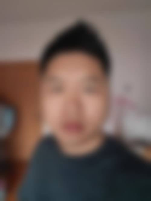长沙大麦微针植发临床典型服务范例