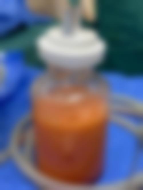 郑州星艺整形医院项目价格参考