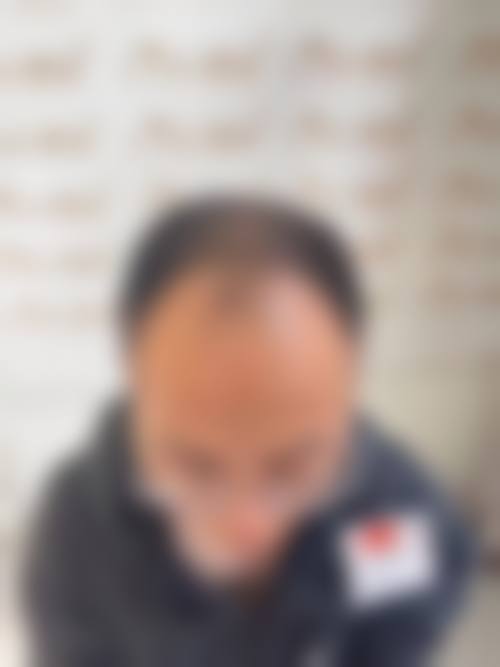 长沙大麦微针植发基本信息
