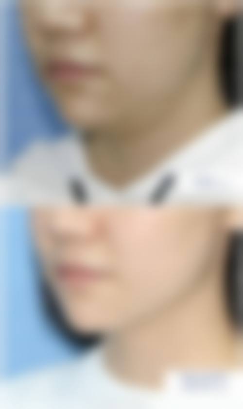 临床实例分享