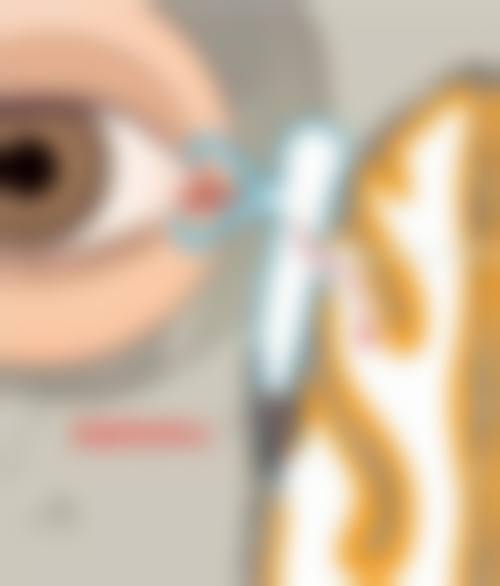 临床实例分享