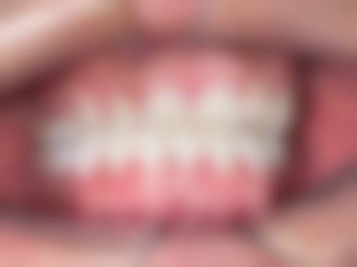 设备环境介绍:数字化设备,无菌保护