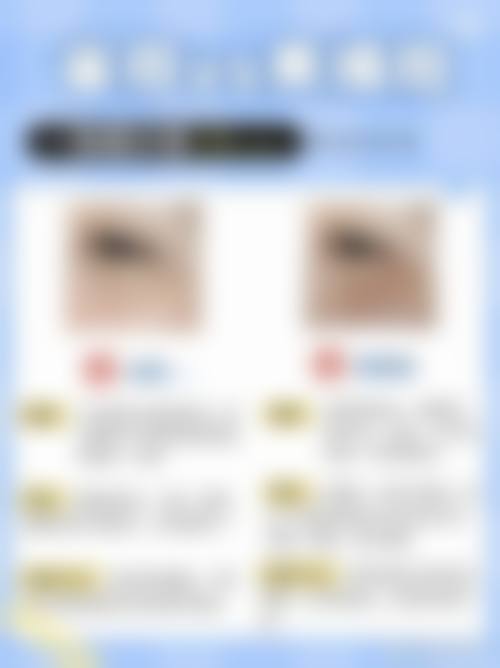 设备环境介绍:前列技术保护手术成效