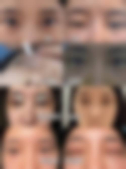 义乌市德尔美客整形医疗美容门诊项目价格参考