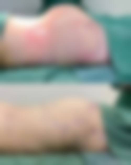 临床实例分享
