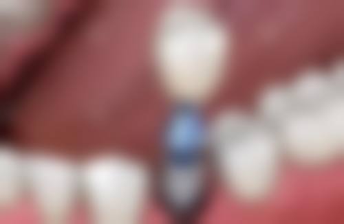 特色科室与项目:覆盖全年龄段口腔需求