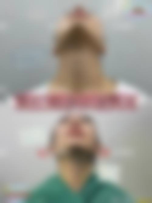 预约优惠活动