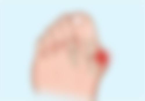武汉硚口千和整形医院怎么预约挂号?