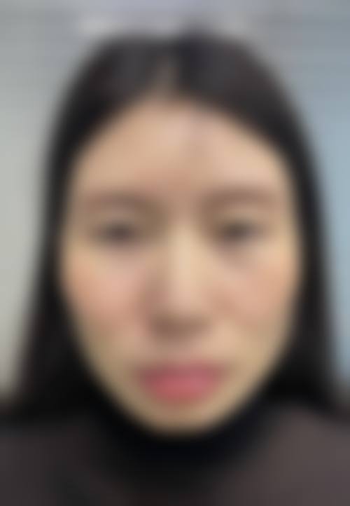 东莞西妃整形医院擅长项目