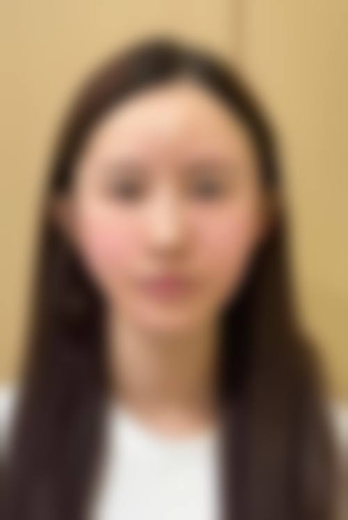 东莞西妃整形医院怎么预约挂号?