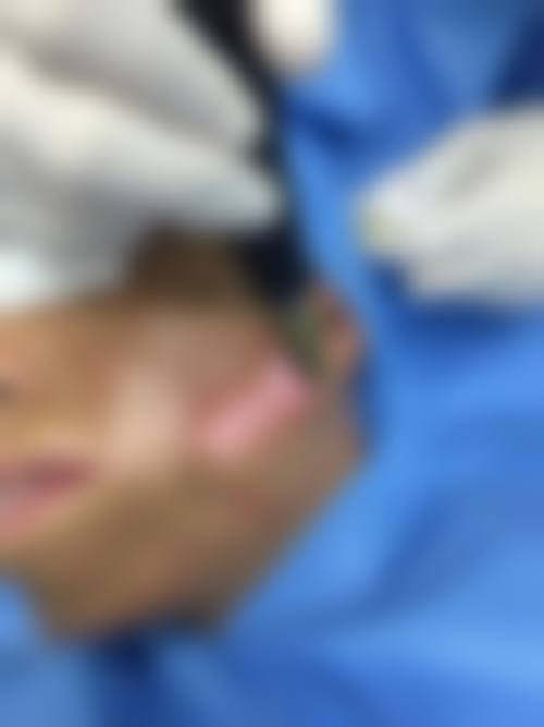 患者真实评价