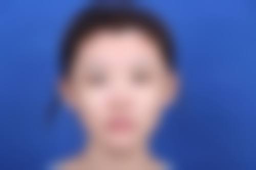 都城SkinClinic擅长项目