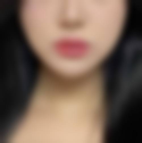 漯河缔美俪整形医院项目价格参考
