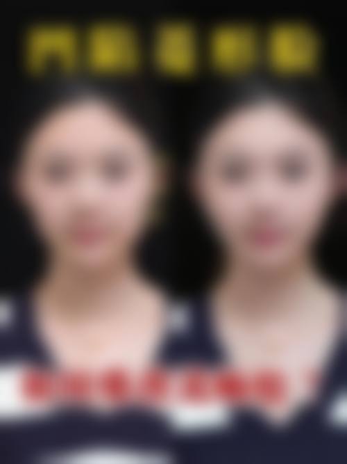 结尾预约号召