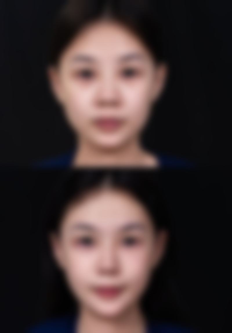 韩国釜山winner整形医院临床典型服务范例